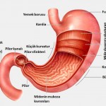 Kronik Atrofik Gastrit Belirtileri